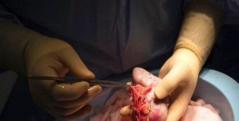 3D打印临床器官距离实现临床应用的路还有多远？国内新闻3D虎