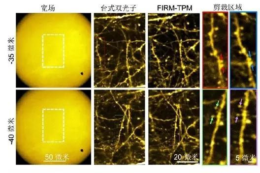 超快光纤激光助力微型双光子显微成像系统研究