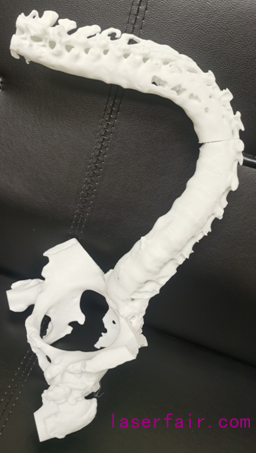 3D技术打印出的脊椎和骨盆
