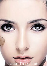 南京激光美白改善女性黄皮肤的方法